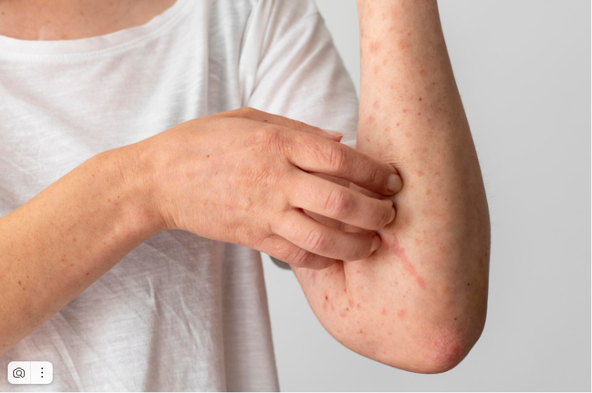 Как и где можно подхватить заразные заболевания кожи?